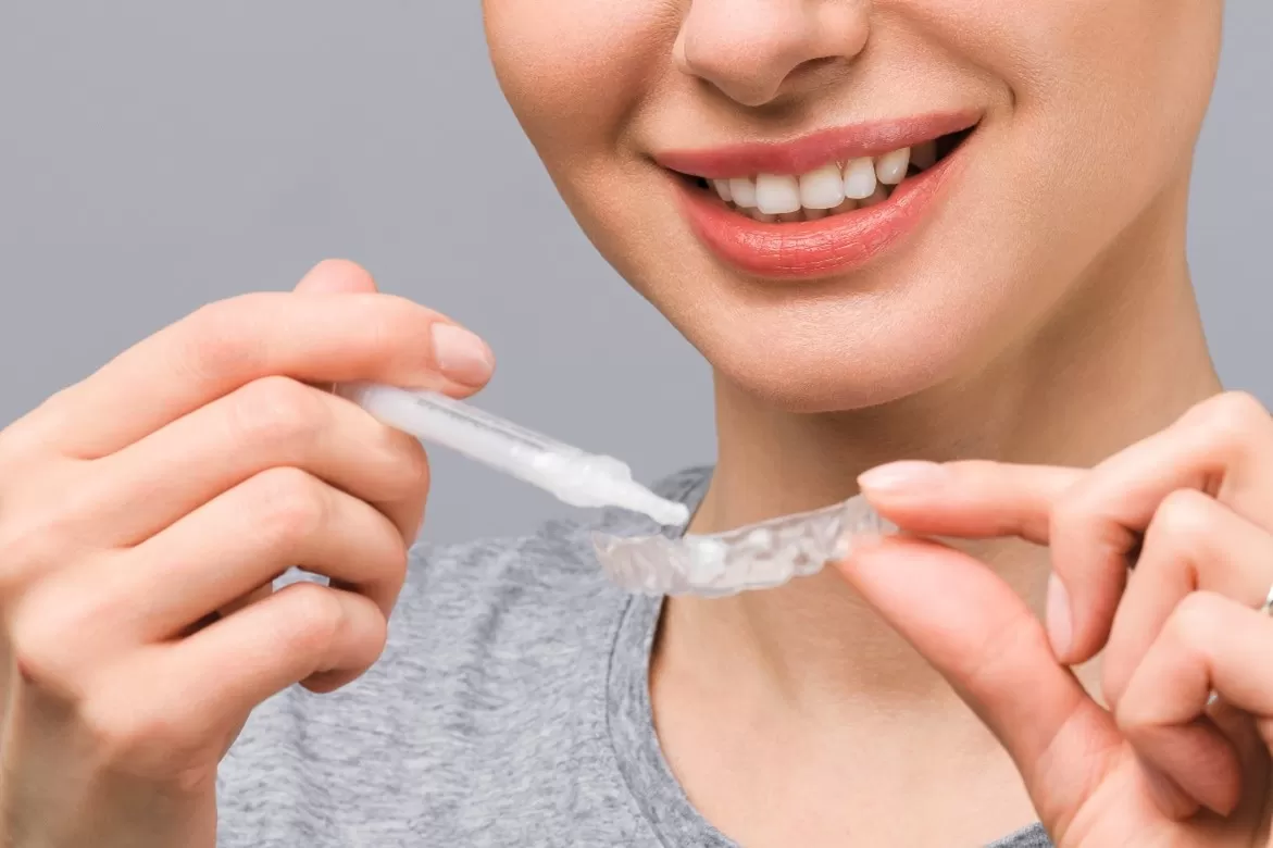 Take-Home Teeth Whitening